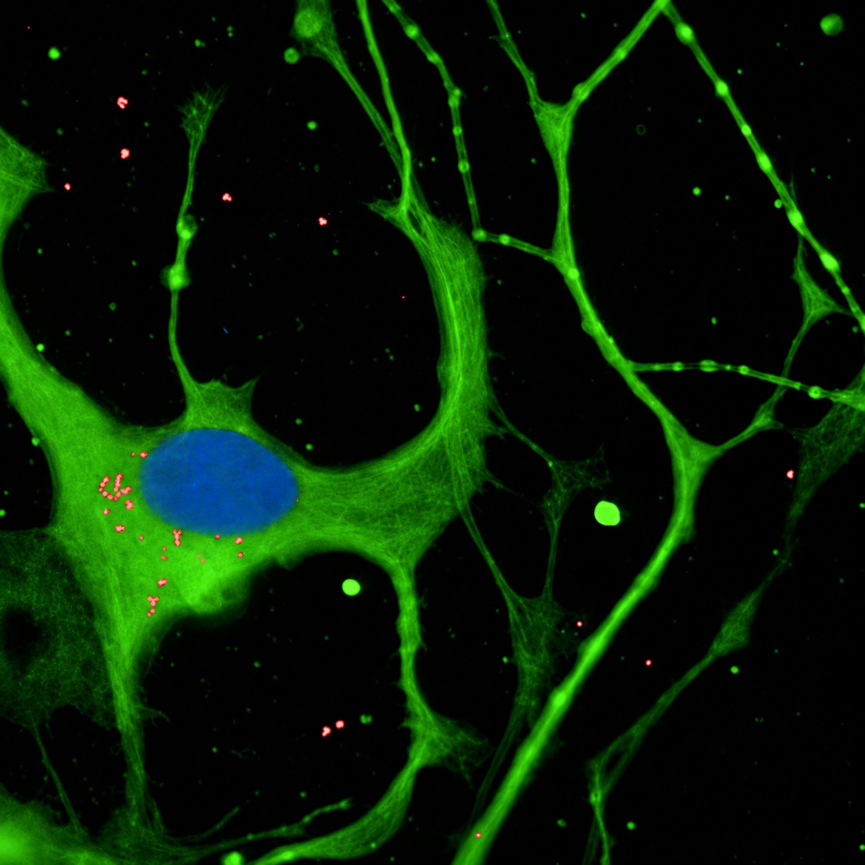 CE-Ventures Backs Aptadir Therapeutics 